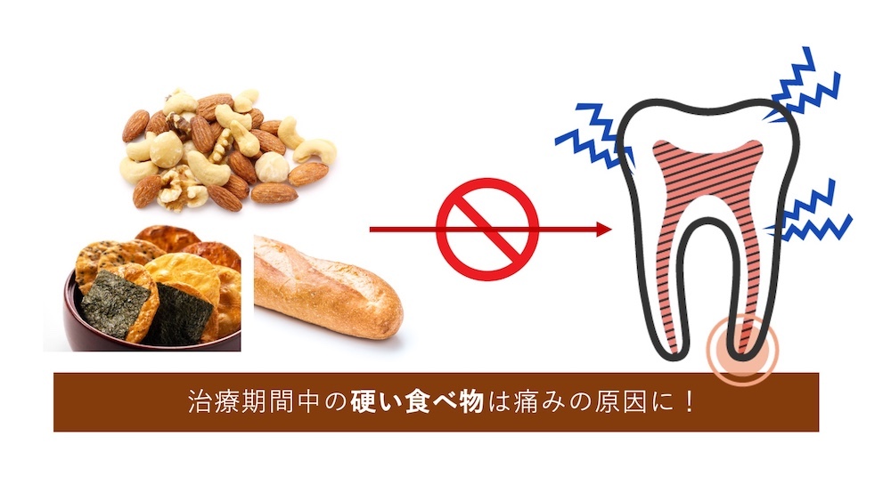 治療期間中の硬い食べ物は痛みの原因に！