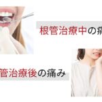歯の神経を抜くのは痛い？治療中・治療後の痛みと適切な対処法を解説