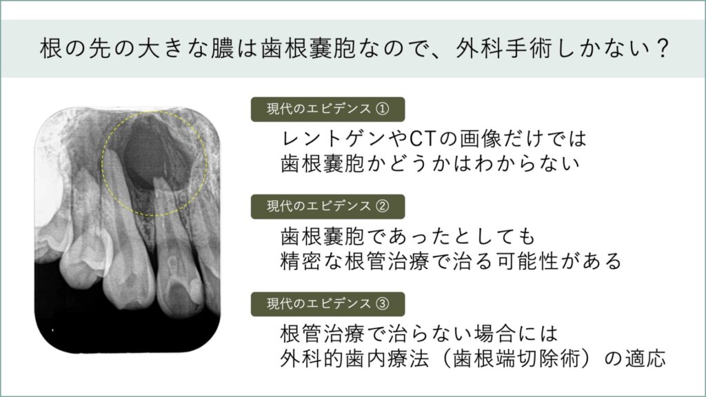 歯根嚢胞は「手術が必要」と限らない