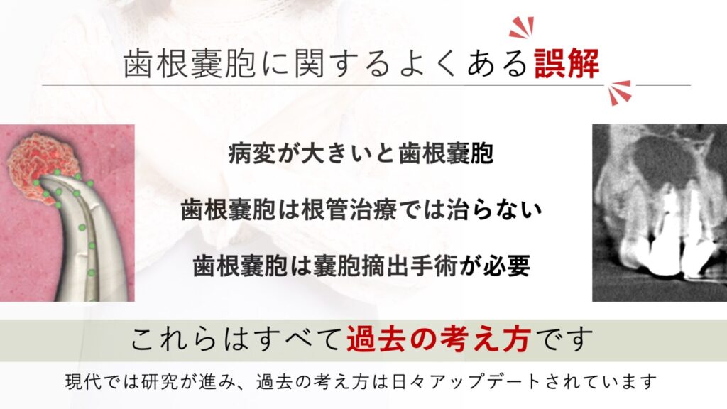 歯根嚢胞は必ず手術が必要？根管治療で治るケースと正しい診断の重要性