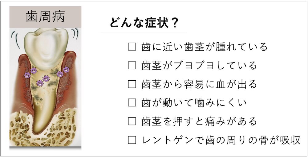 症状例：出血・膿・歯肉の赤みなど