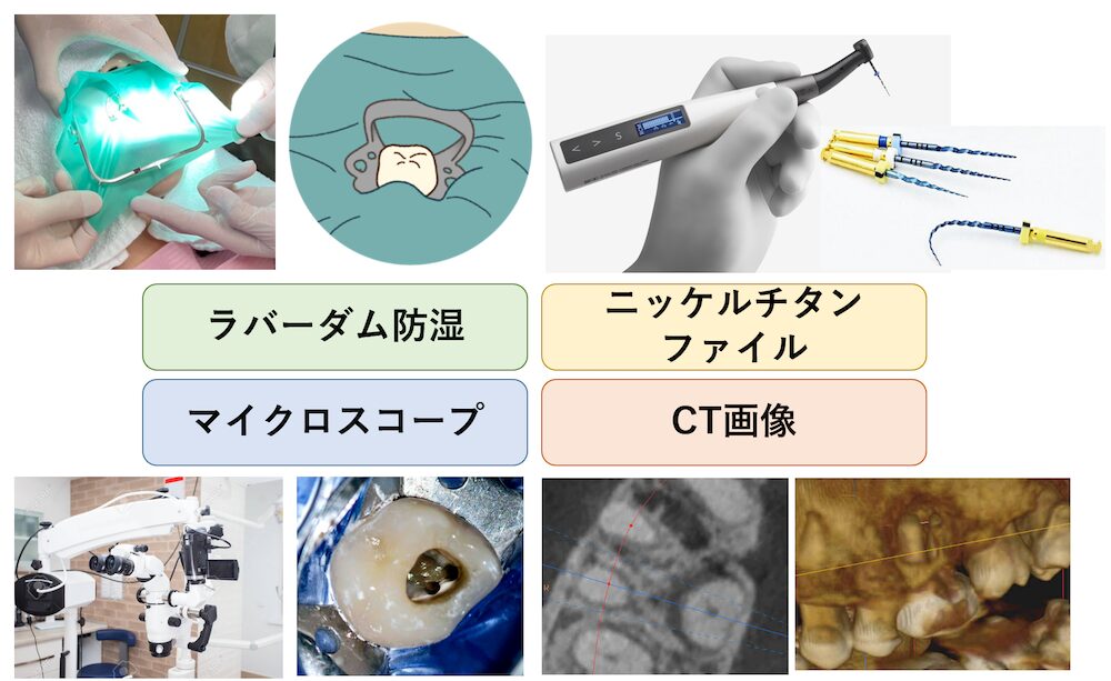 精密根管治療の設備・技術