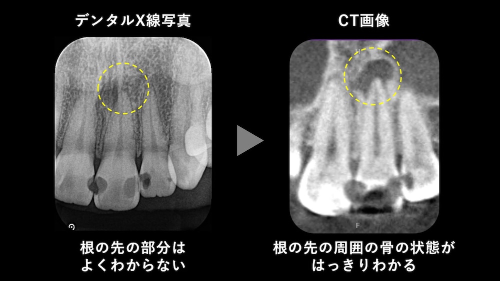X線・CTによる診断