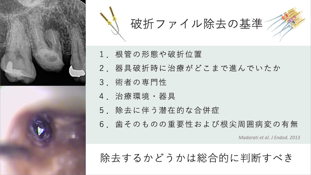 破折ファイル除去の判断基準|除去すべきケースと不要なケース