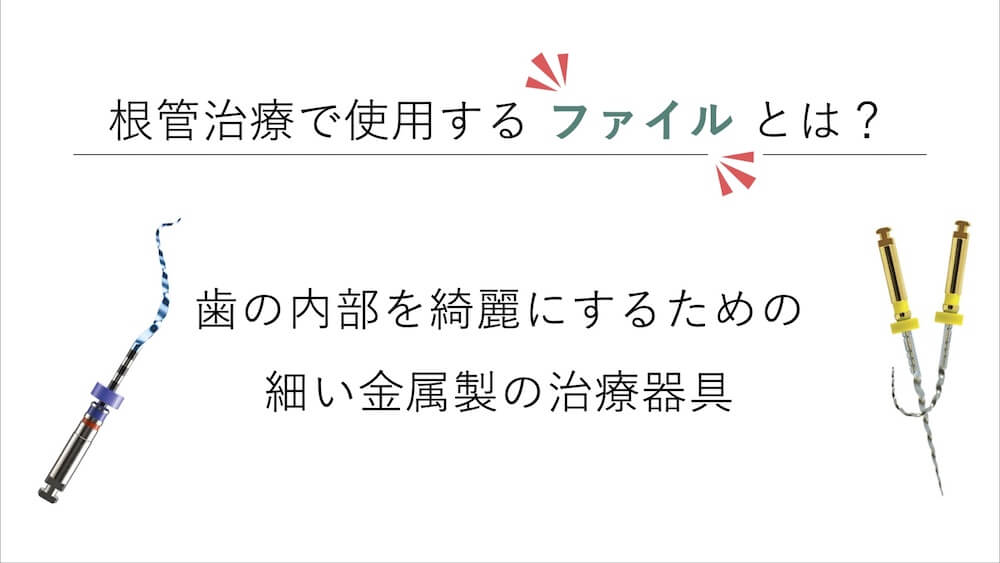 ファイルとは|根管治療で使用する清掃器具