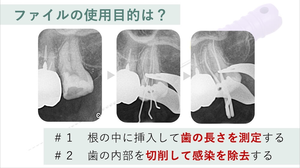 破折ファイルが発生する原因