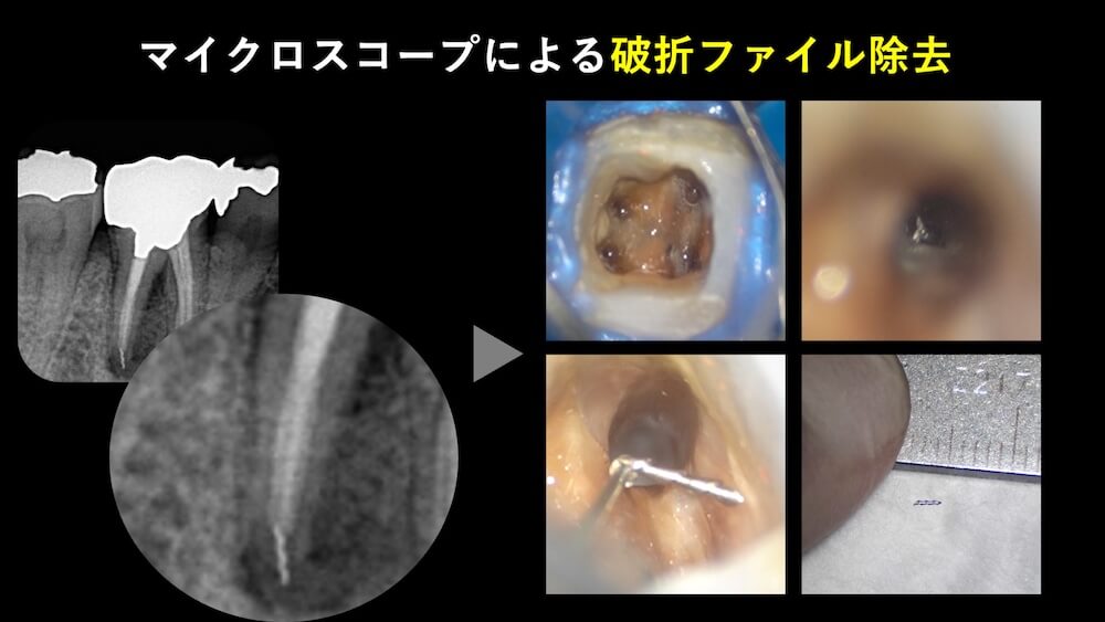 マイクロスコープの重要性