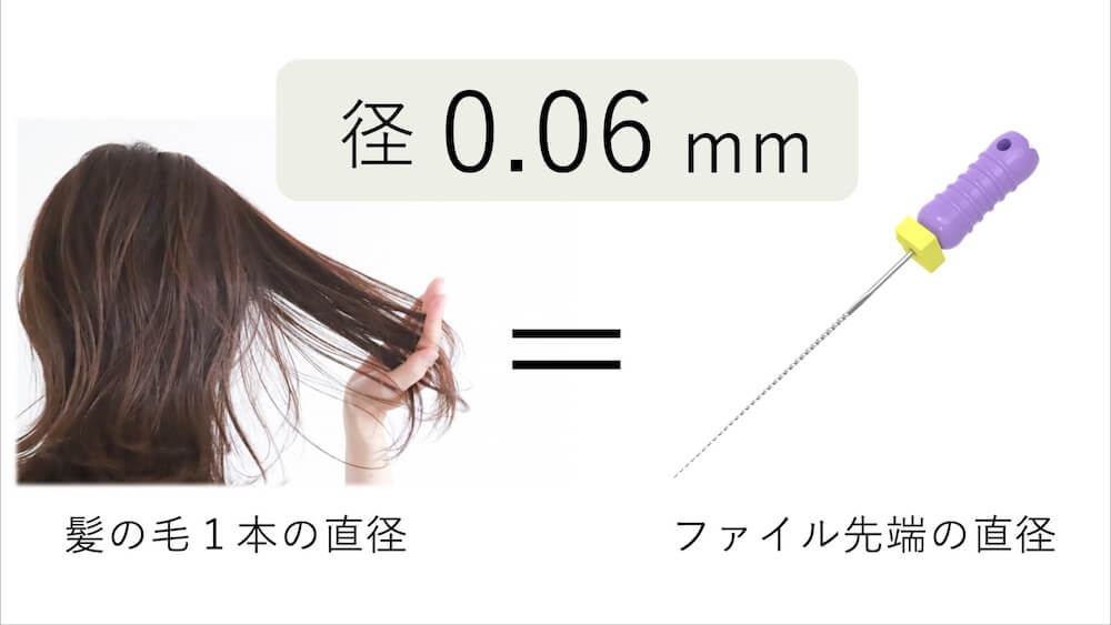 ファイル先端の直径は0.06mm髪の毛1本の直径