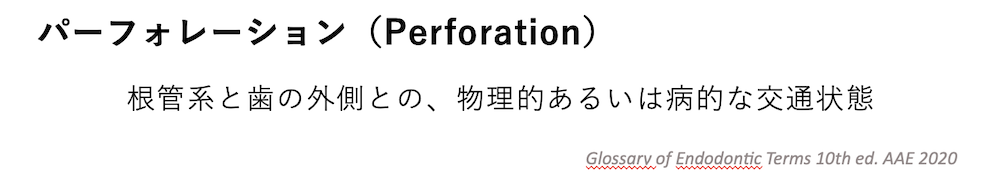 パーフォレーション（穿孔）とは？根管治療中に「歯に穴があいた」と言われた方へ｜原因・症状・治療と予後