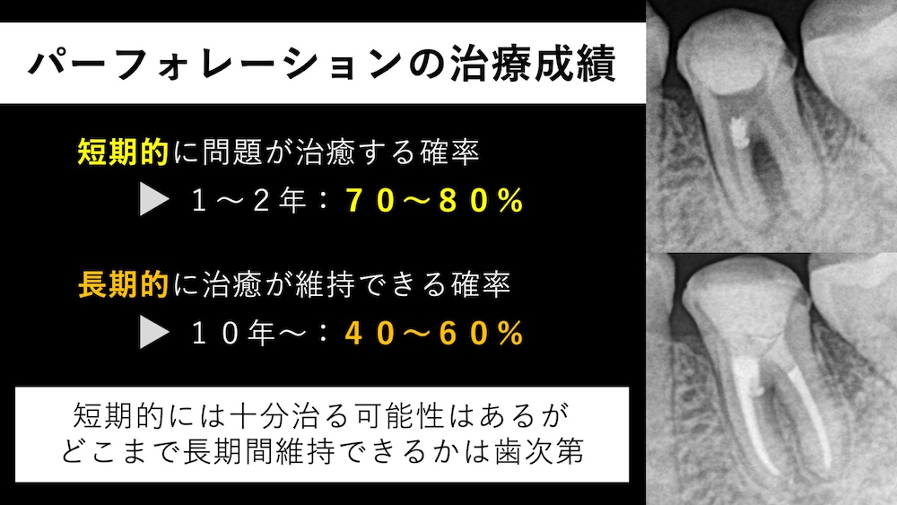 セカンドオピニオンを受ける価値のあるケース