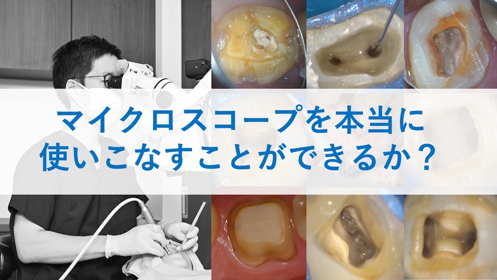 マイクロスコープを使うことのメリット