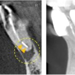 レントゲン画像