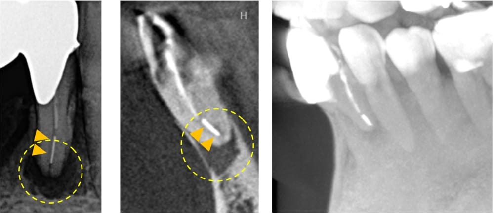 レントゲン画像