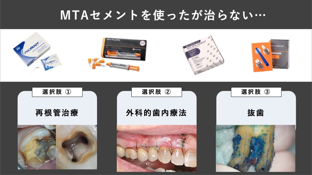 image_tooltip MTA使用後も治らない場合の選択肢
