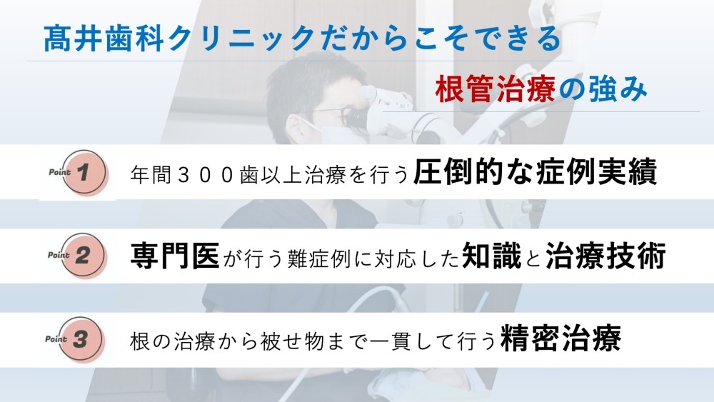 image_tooltip 根管治療の強み
