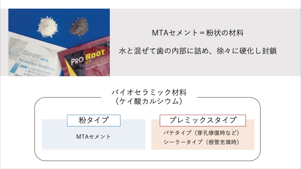 image_tooltip MTAセメントとは何か?その成分と特性