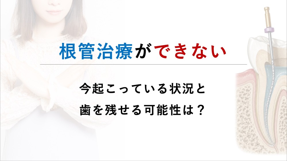 根管治療ができないケースとは？治療できない歯の判断基準と残せる可能性を専門医が解説