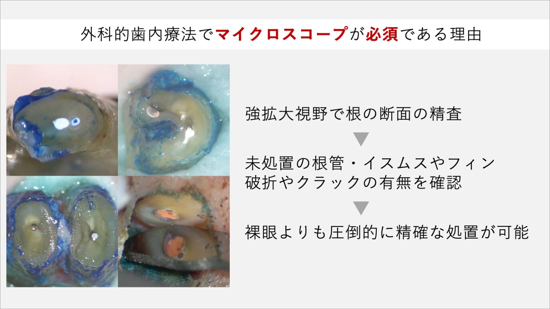 image_tooltip 根の先を切っただけでは再発することがある