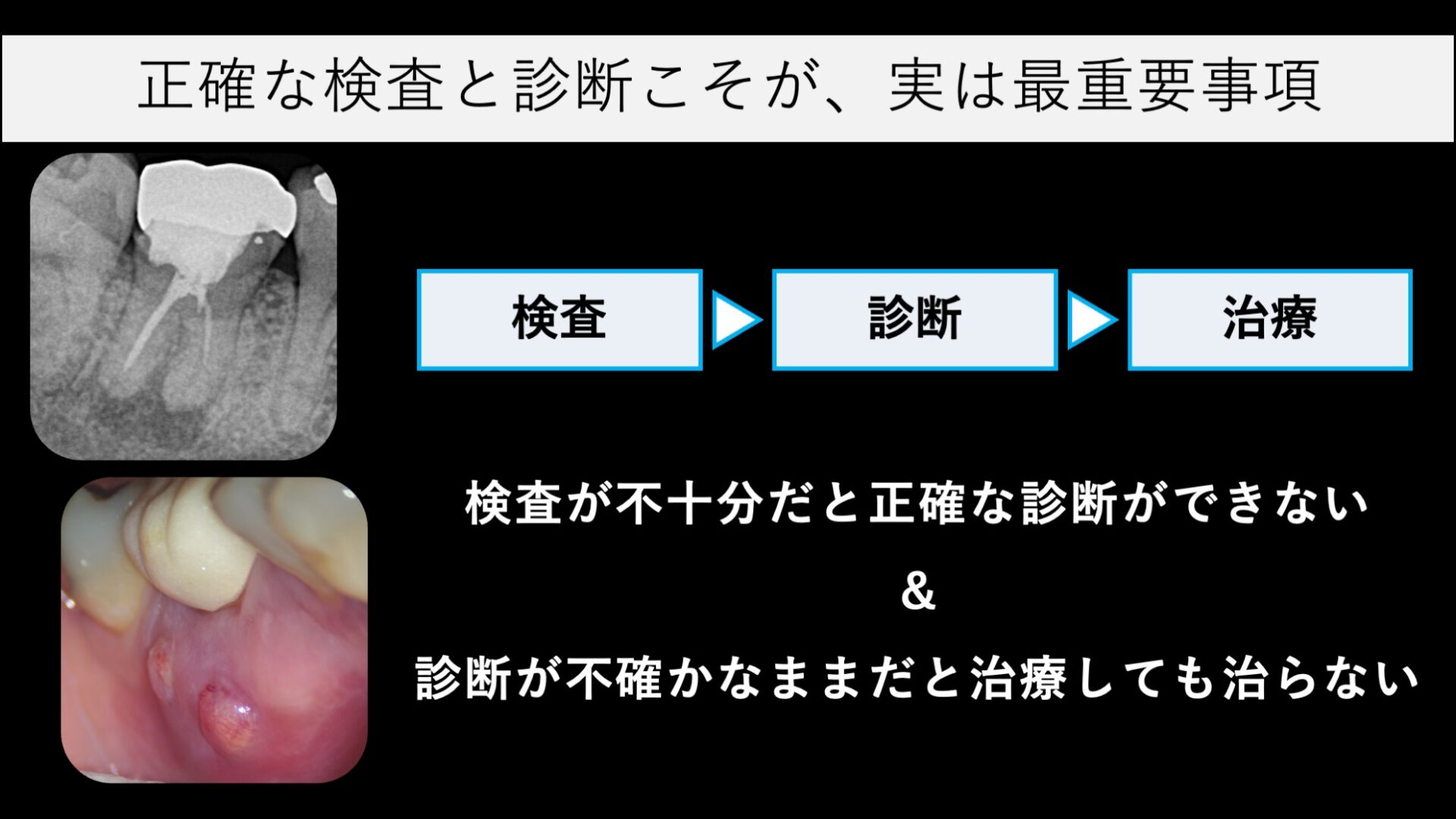 image_tooltip 専門的な診断と治療を受けられていない