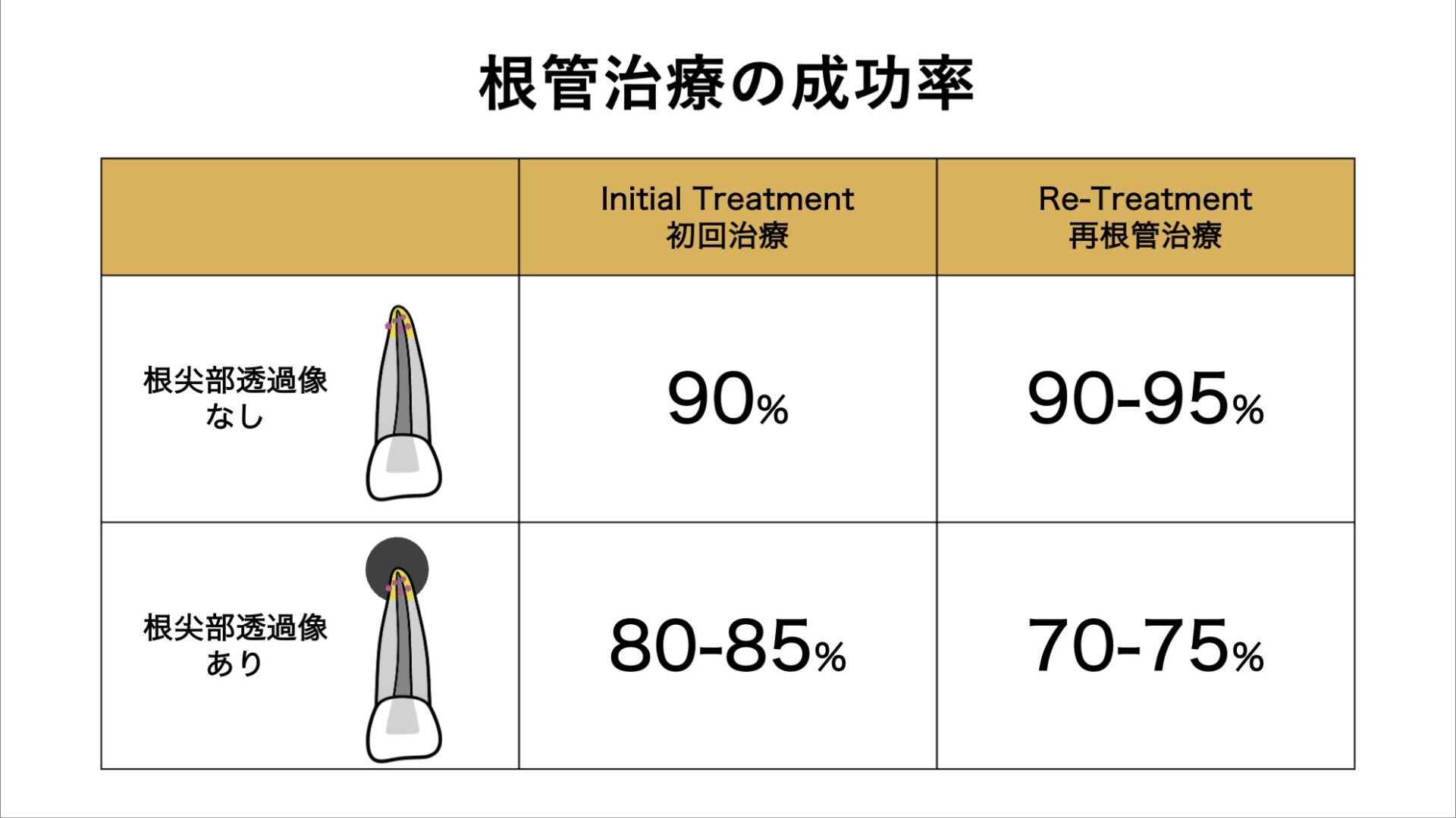 image_tooltip 再治療は初回治療より成功率が下がる