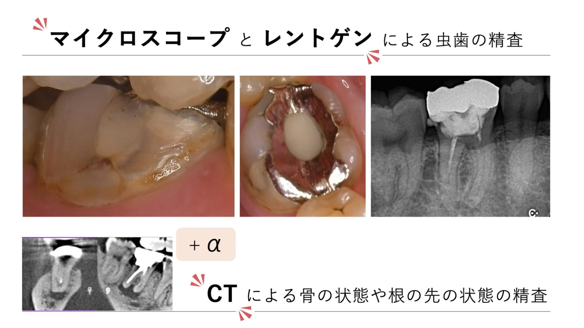 image_tooltip 拡大視野での確認が取り残しを防ぐ