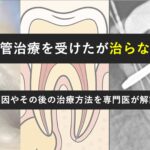 根管治療をした歯が治らない時はどうする？根管治療を受けた歯が治らない原因とその後の治療の選択肢を解説