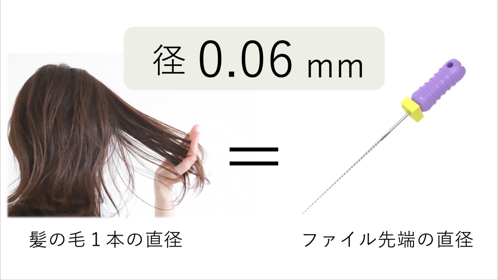 image_tooltip 根管が見つかりにくくなる条件