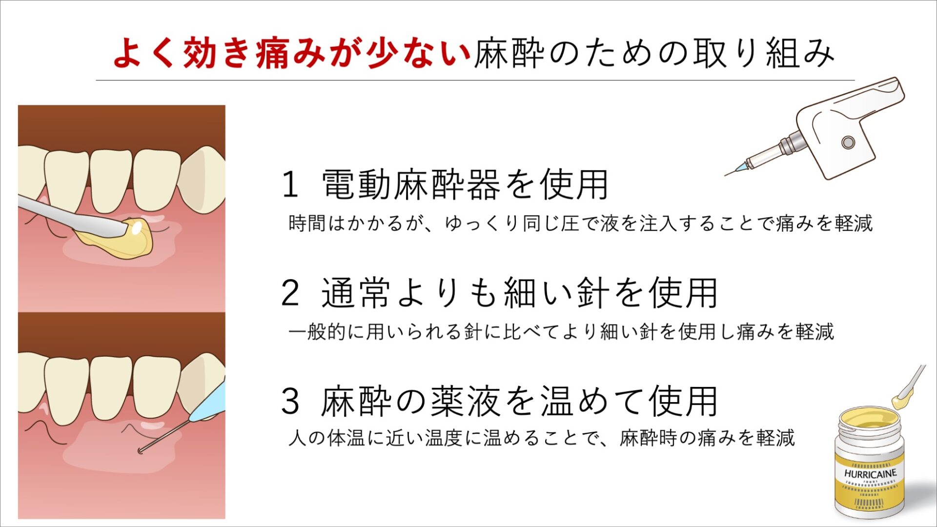 ラバーダム装着時の痛みがないように麻酔をする