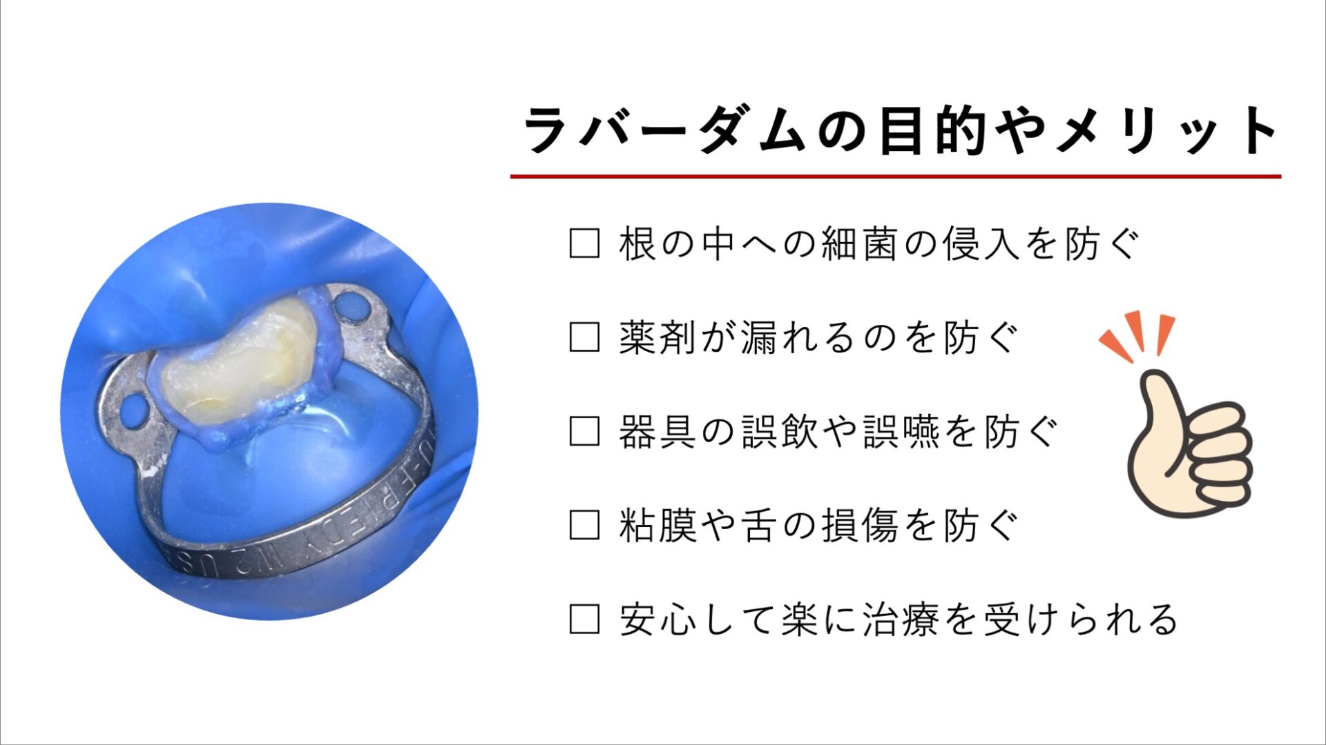 ラバーダムを使う目的とメリット