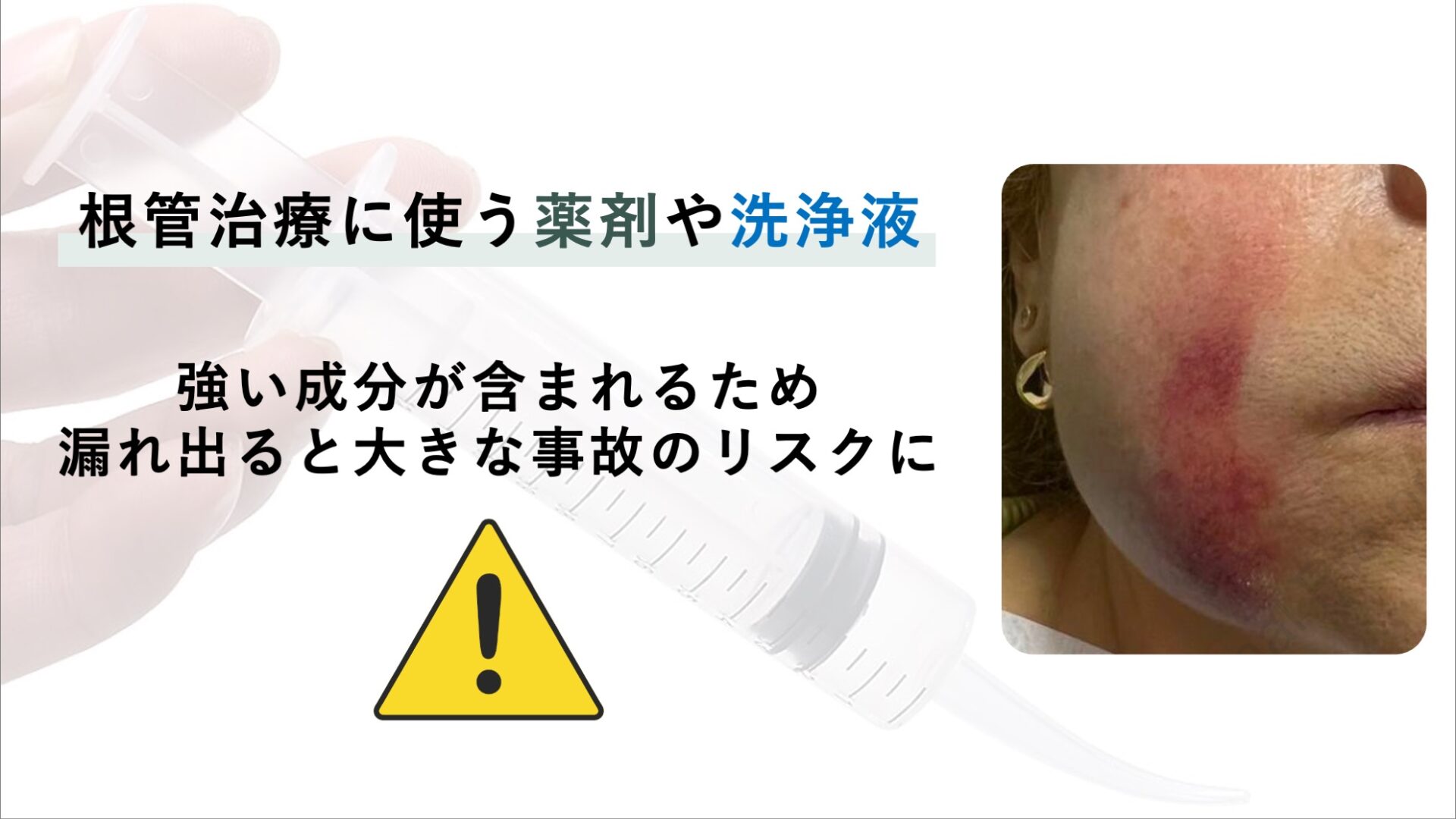 洗浄液や薬剤が口の中に漏れるのを防ぐ
