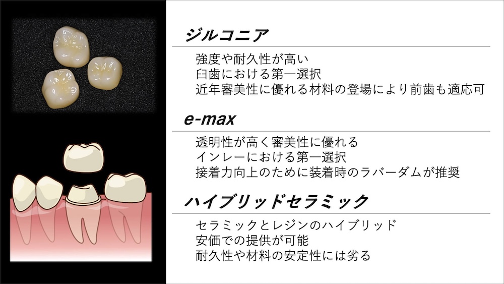 最新のセラミック素材について