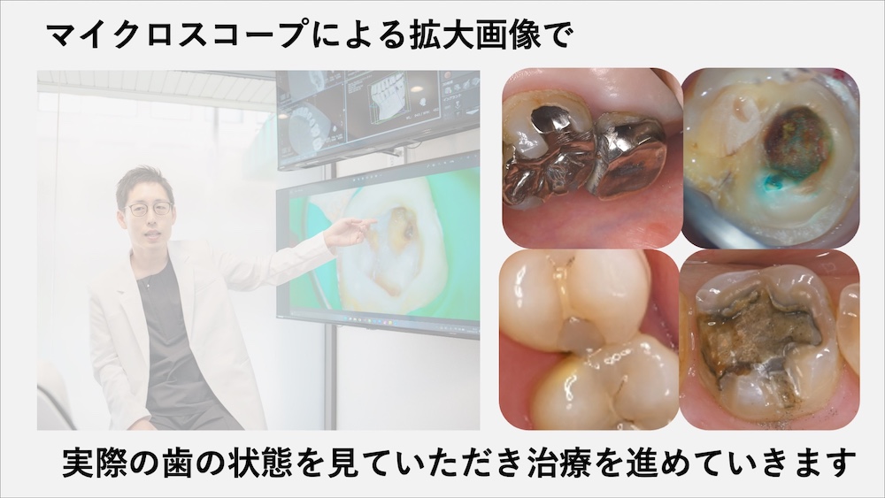 マイクロスコープ完備による可視化診療