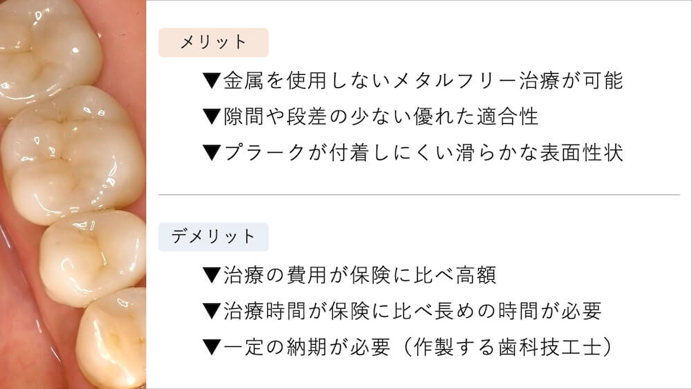 自費の被せ物（ジルコニア／E-max等）について