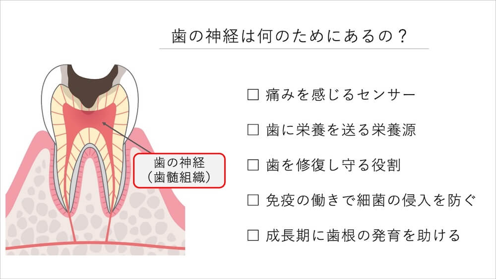 神経がない歯は痛みで気づきにくいことがある