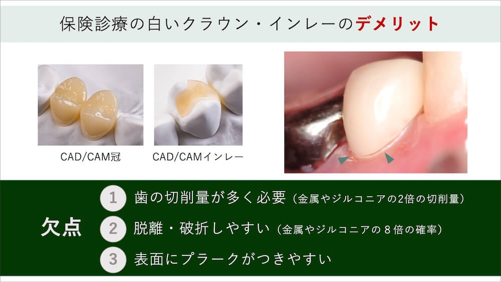ただし再治療を避けたい方には不向きな側面がある