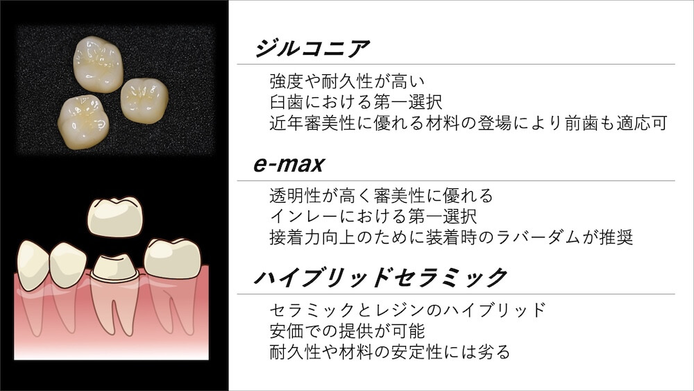 当院ではジルコニアをお勧めしています