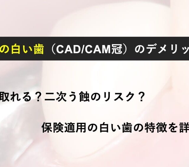 保険適用の白い歯（CAD/CAM冠）のデメリット｜割れる・外れる・虫歯の再発を避けたい方へ