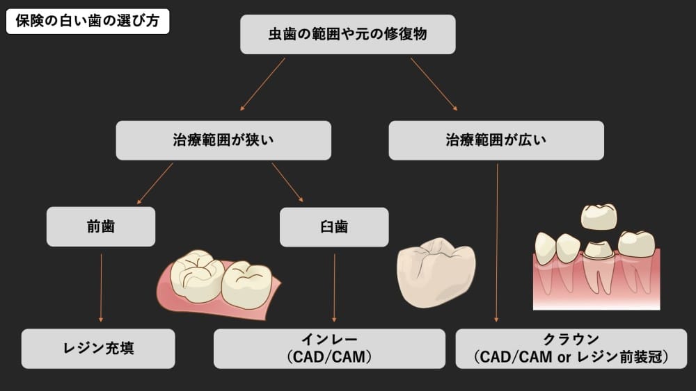 image_tooltip 保険の白い歯の選び方