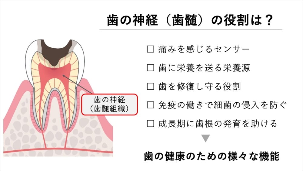 神経を取った歯は再発に気づきにくい
