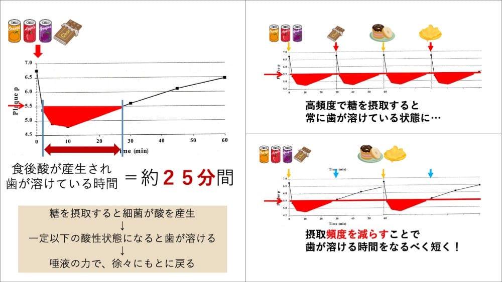 虫歯の再発リスクを下げる有効な方法のひとつが、糖分の摂取頻度を下げること